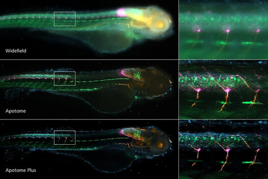 ZEISS Apotome 3: Confocal-Quality Imaging Without the Confocal Price